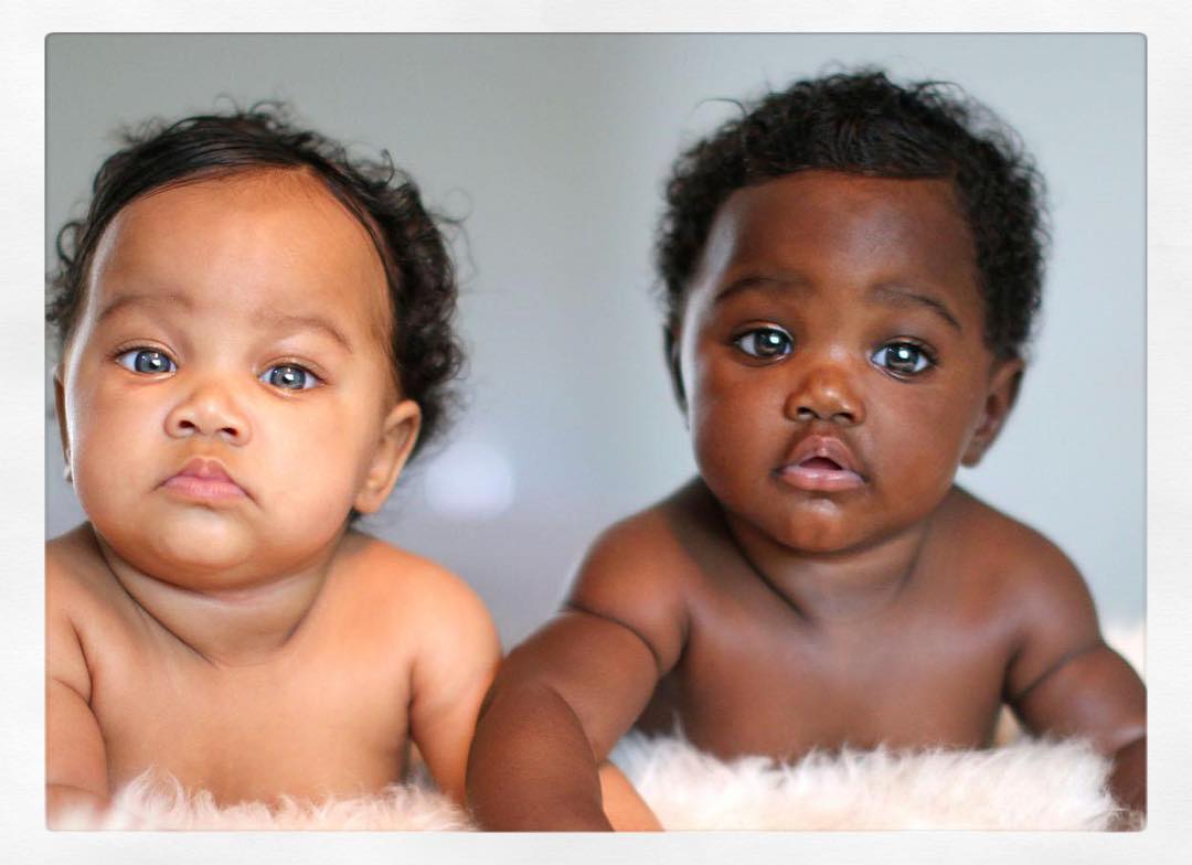 Uma negra e outra branca: as gémeas “milagre” que são capa da National Geographic Uma negra e outra branca: as gémeas “milagre” que são capa da National Geographic