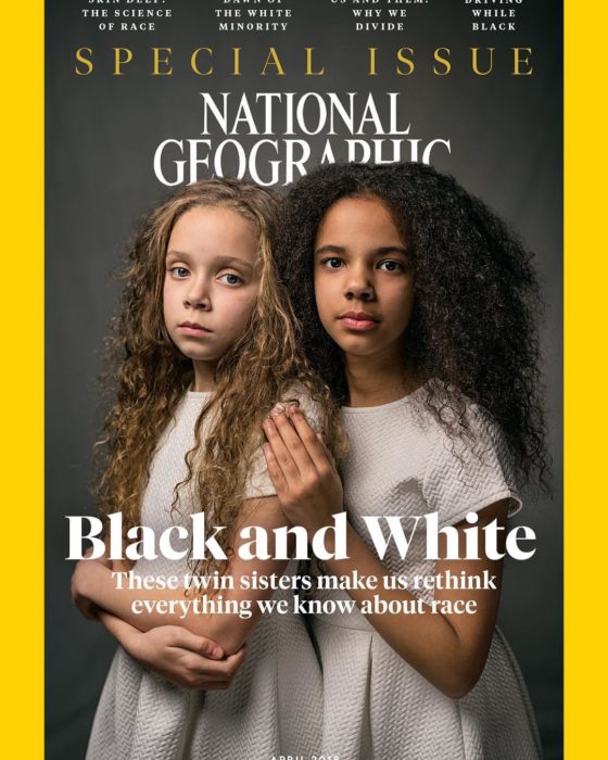 Uma negra e outra branca: as gémeas “milagre” que são capa da National Geographic