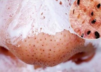 máscara caseira para limpeza