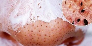máscara caseira para limpeza