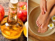 vinagre de maçã nos pés