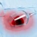 Tome nota das sugestões que temos para si para poder remover manchas secas de vinho tinto do algodão.