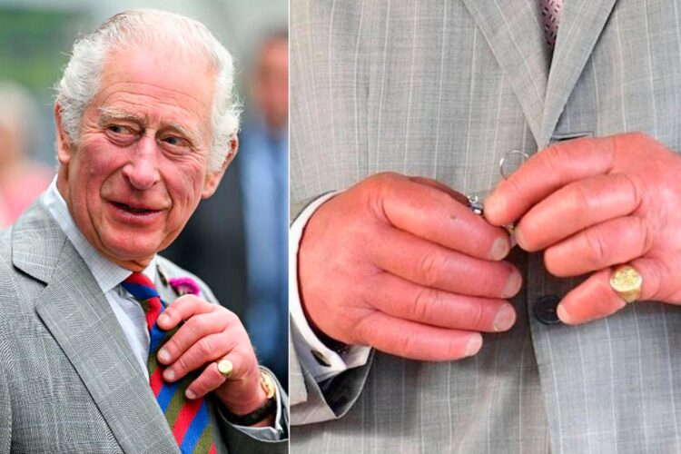 A história e as teorias por trás dos dedos de salsicha do rei Carlos III.